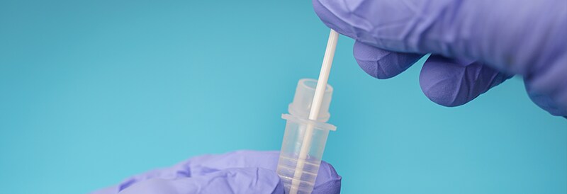 Shop molecular tests