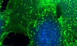 Immunoassays