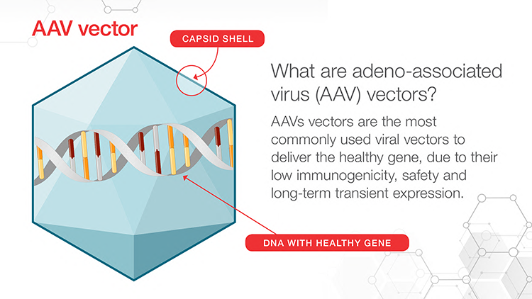 AAV-Based Gene Therapies