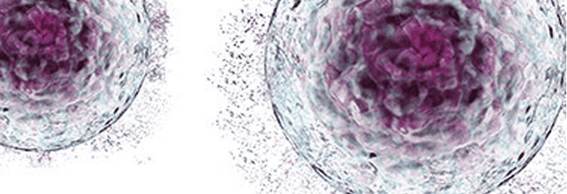 Equipment Challenges in Scaling Up Cell Therapy Processes